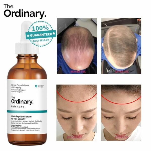 سرم ضد ریزش مو اوردینری مولتی پپتید Ordinary Multi Peptide