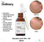 سرم ماندلیک اسید اوردینری ضد لک Ordinary Mandelic Acid