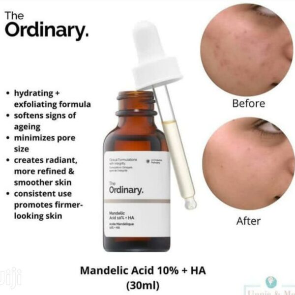 سرم ماندلیک اسید اوردینری ضد لک Ordinary Mandelic Acid