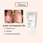 کرم آزلائیک اسید اوردینری ضد جوش Ordinary Azelaic acid